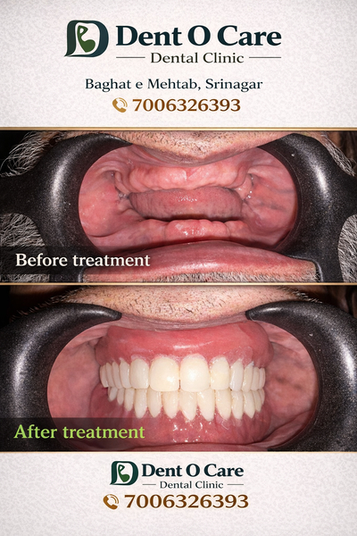 Cover photo of DENT-O-CARE